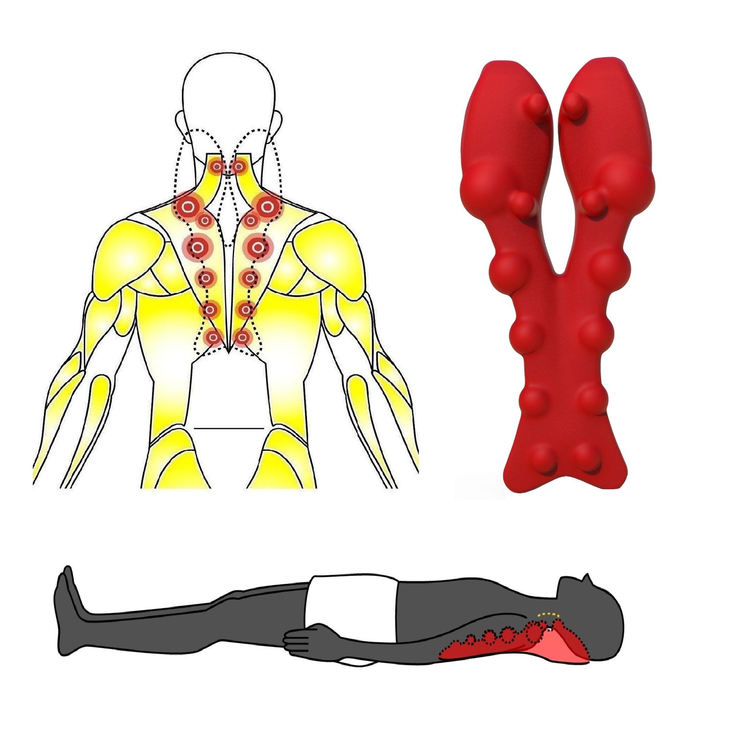 Trapezius muscle knot locations matched to pressure point nodes