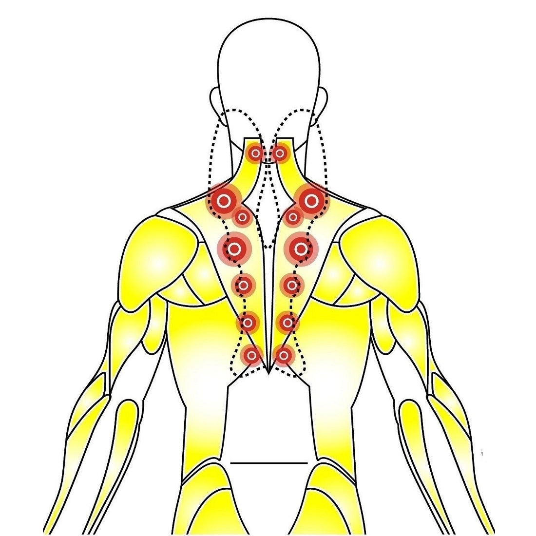 Trigger Point & Deep Tissue