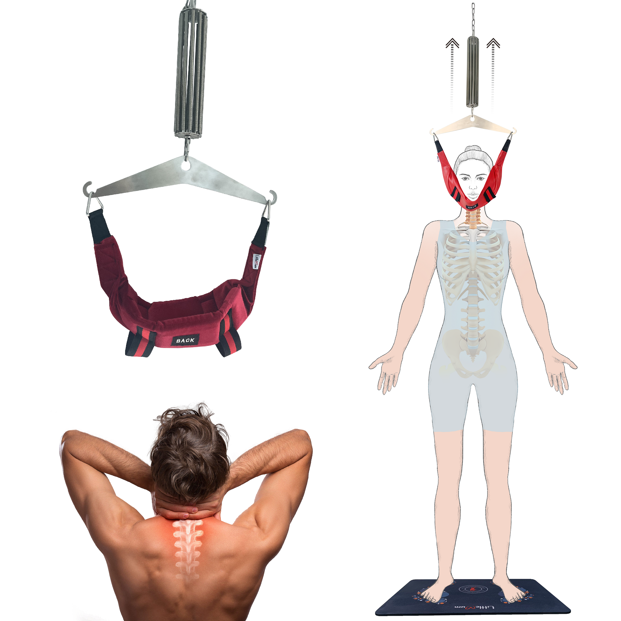 cervical tenting LittleMum Cervical Traction Apparauts, Cervical Decompression for Cervical  Radiculopathy, Neck Pinched Nerve,Misalignment of Cervical Bones, Cervical  Disc Disease, Spondylosis, Stenosis – LittleMumcare