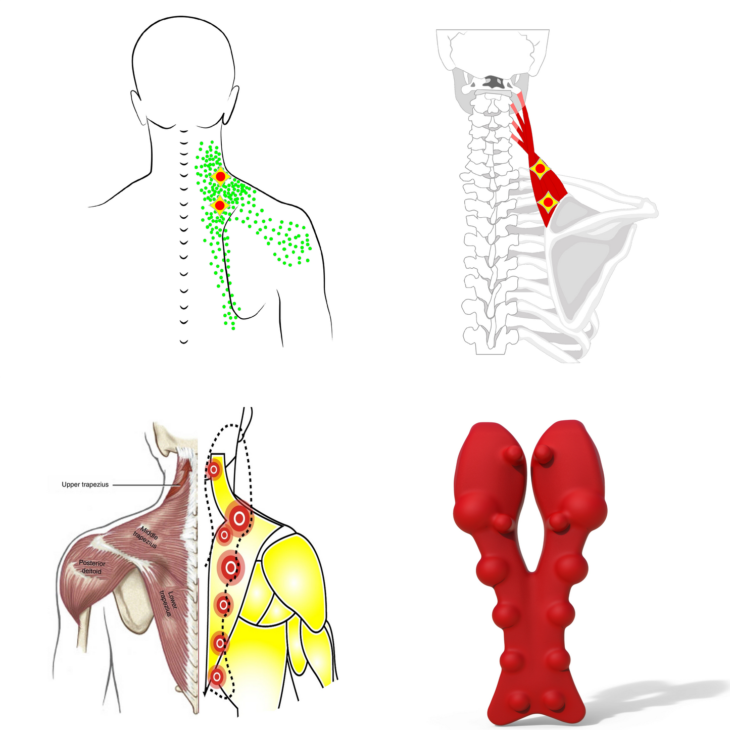 Levator Scapulae Syndrome Relief