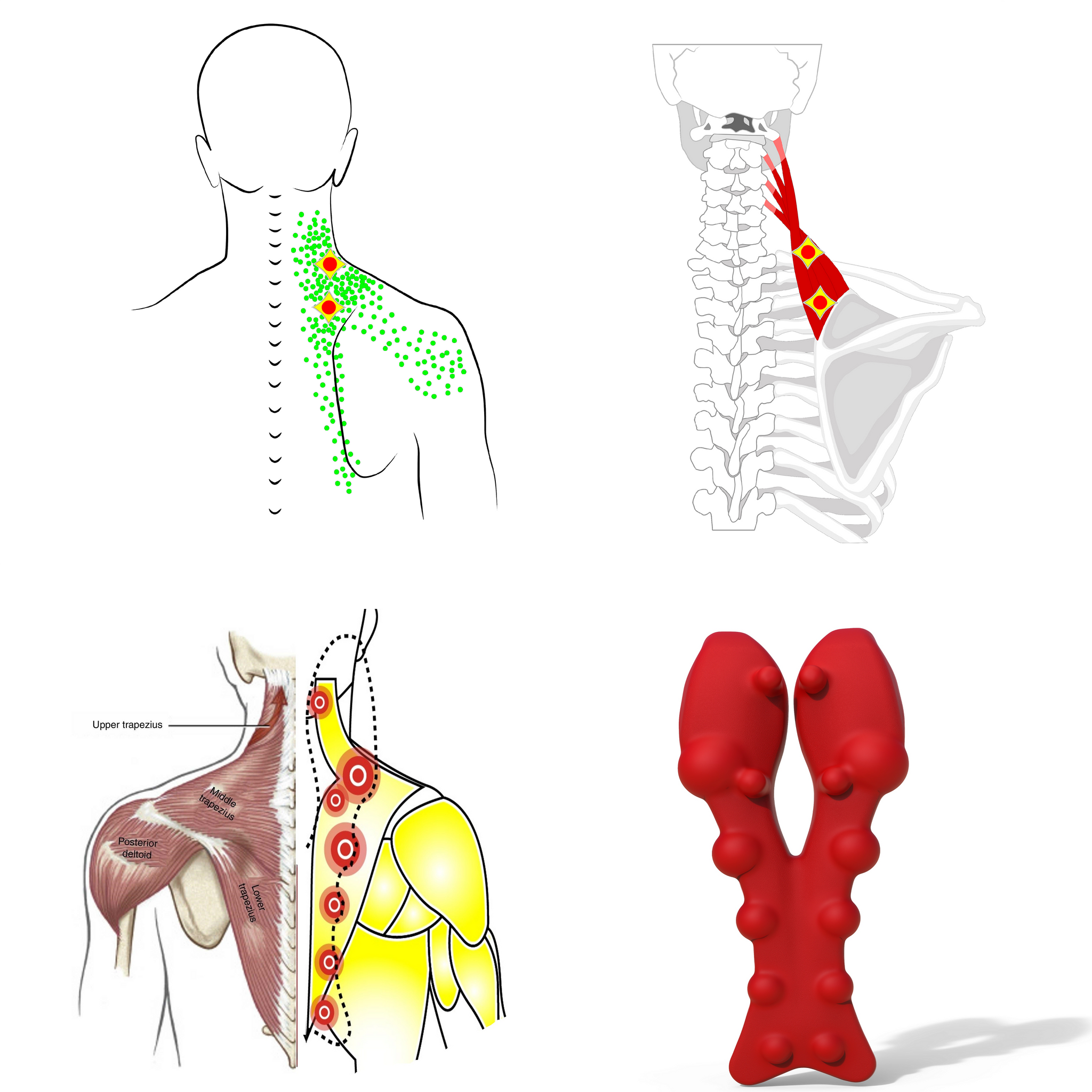 ZeenKind Occipital Release Tool & Trapezius Trigger Point Massager for Neck  Shoulder Muscle Pain Rel…See more ZeenKind Occipital Release Tool 