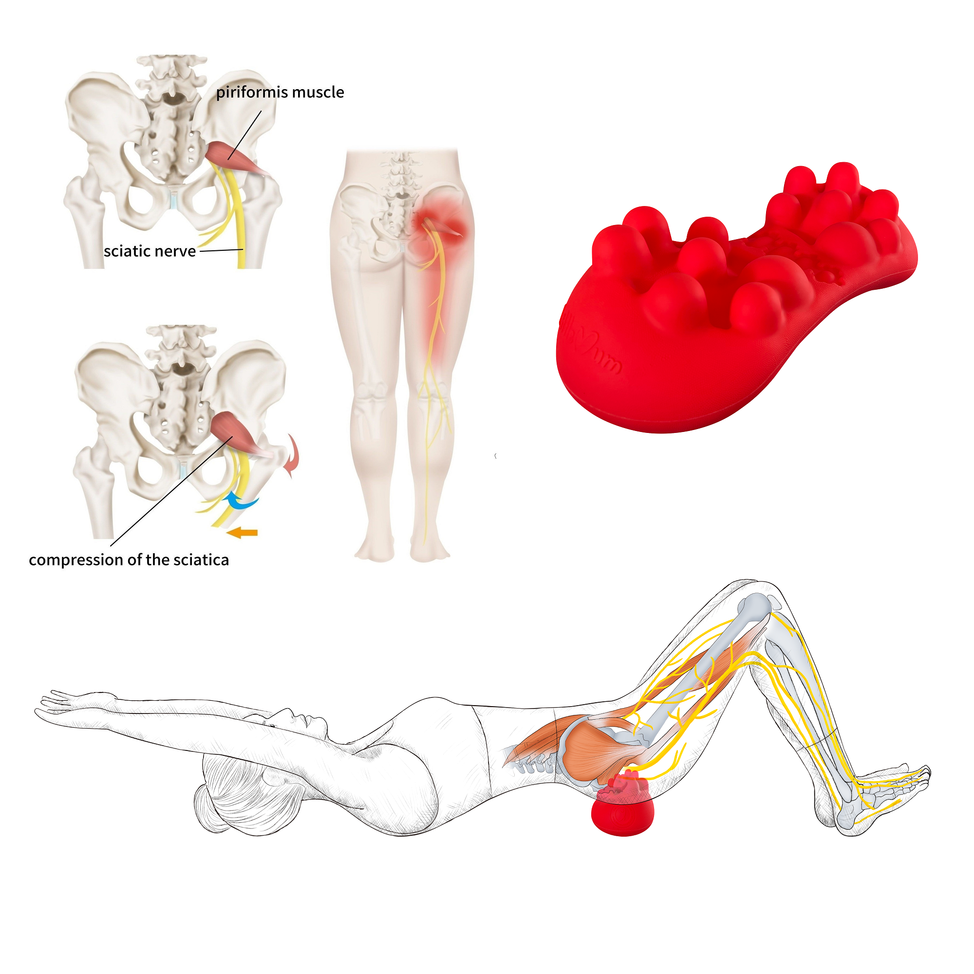 Hip and Butt Pain Trigger Massager