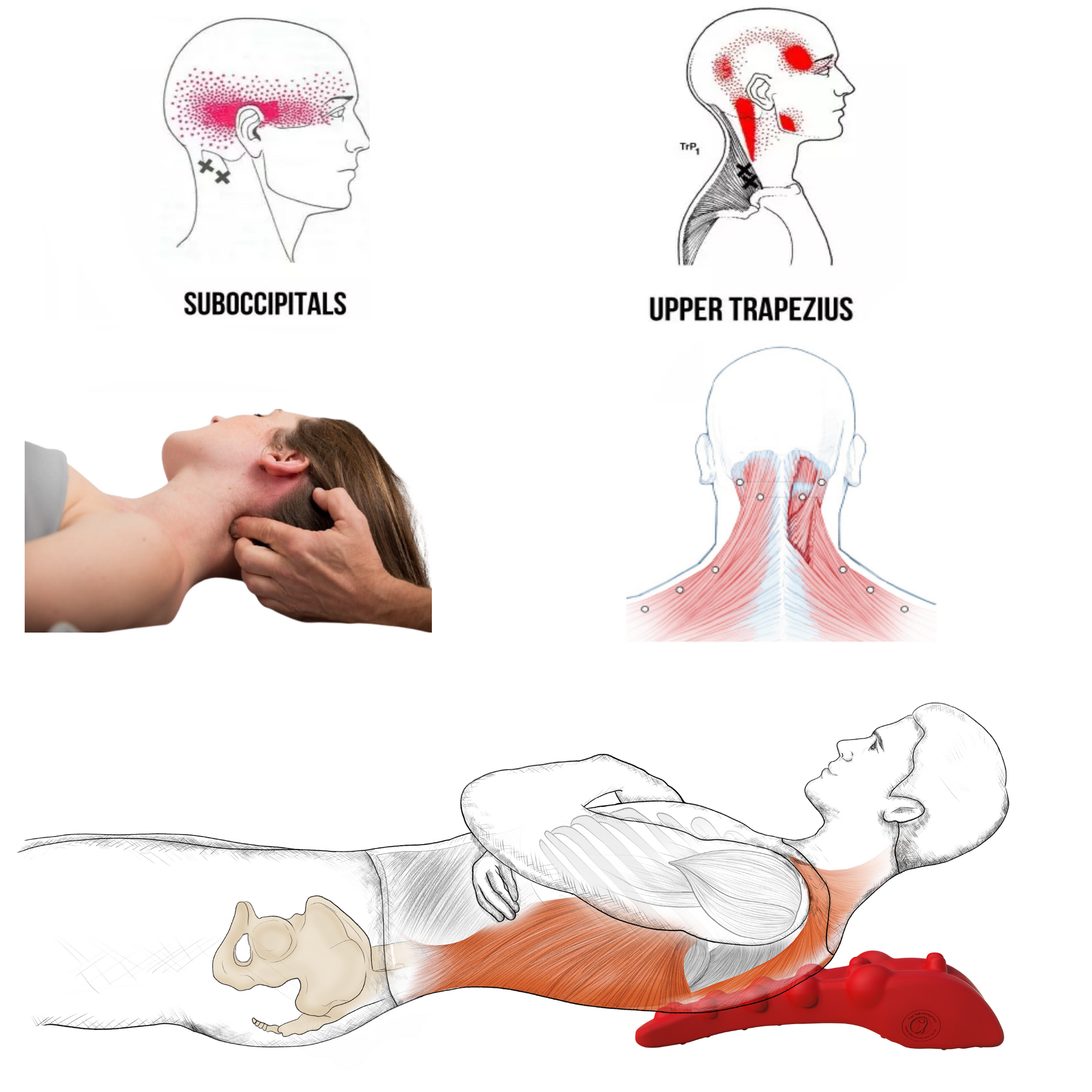 Trapezius muscle pain & trigger points