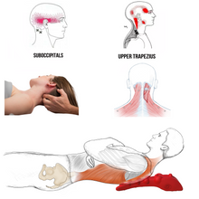 Load image into Gallery viewer, An upper trapezius spasm/build-up of scar tissue/tension can be a real source of pain referring to the neck, lateral head, and front of the head. This can manifest as headaches or more severe migraines. This onset of pain seems to be driven by an over activity of the trapezius muscle in people with rounded shoulders, forward head postures, and weak neck muscles at the front of the neck.
