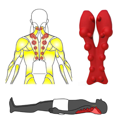 How to Self-Massage Your Trapezius Muscle? What causes trapezius muscle knots? Poor cervical (neck) neck positioning and posture that shift your head's load forward cause inefficient loading to the cervical spine and put additional strain on the muscles at the back of your neck, including your trapezius. This is so much more common now with the ubiquitous use of cell phones