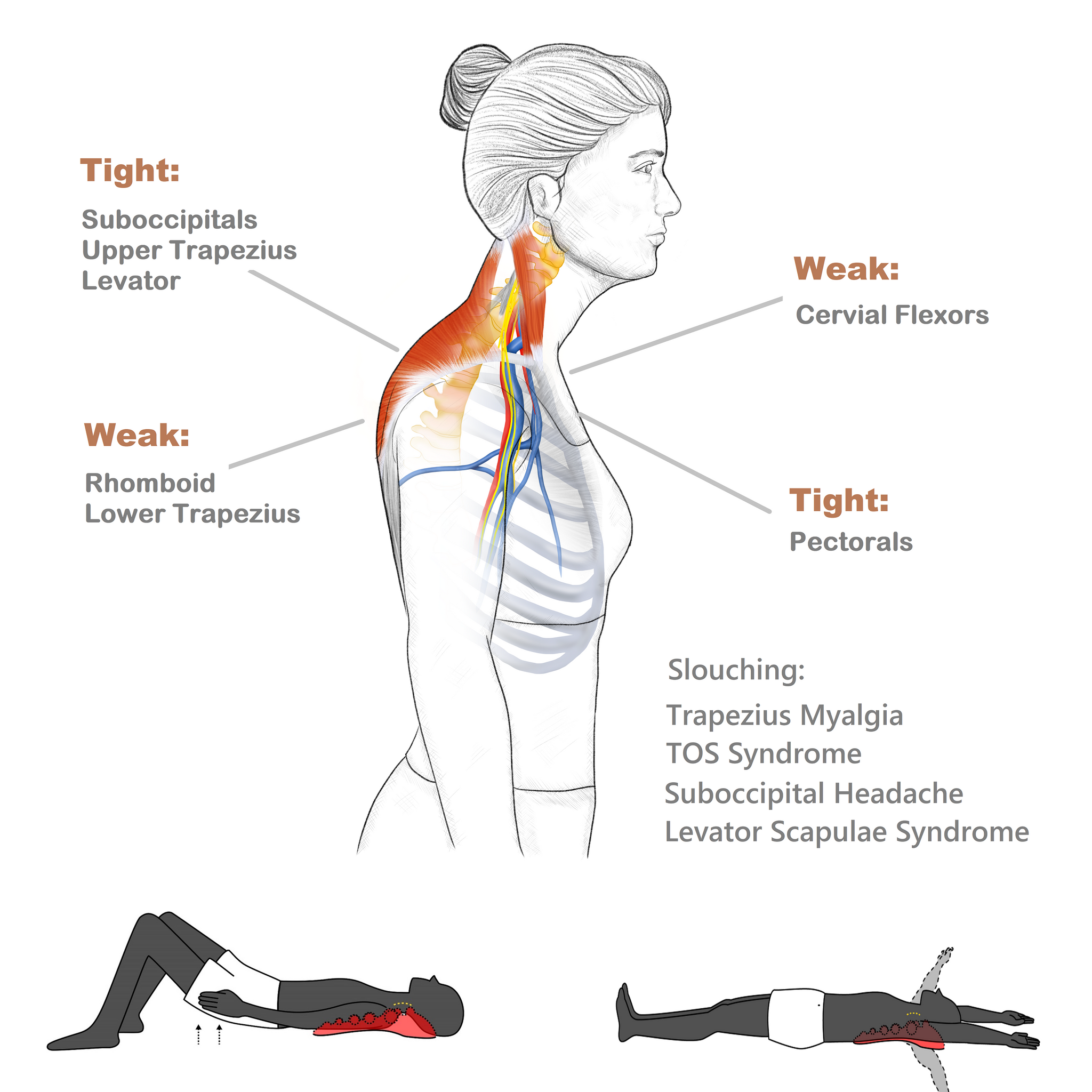 The Benefits of Massage Therapy for Trapezius Strain
